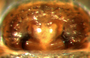 Ceratinella acerea female epigynum