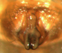 Hybauchenidium cymbadentatum female epigynum