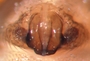 Hybauchenidium gibbosum female epigynum
