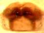 Masoncus pogonophilus female epigynum