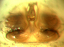Scotinotylus patellatus female epigynum