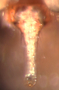 Tunagyna debilis female epigynum