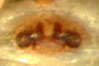 Walckenaeria dixiana female epigynum