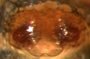 Walckenaeria subspiralis female epigynum