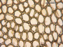 Median cells of Calypogeia muelleriana subsp. blomquistii R. M. Schust. (Holotype).  This project kindly supported by the Grainger Foundation, The Museum Collection Spending Fund (Field Museum), and the National Science Foundation (Award No. 1057418 & 0749762).