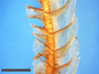 Chiloscyphus edentatus J.J. Engel (Holotype), lateral view of shoot. This project kindly supported by the Grainger Foundation, The Museum Collection Spending Fund (Field Museum), and the National Science Foundation (Award No. 1057418 & 0749762).