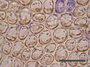 Median cells of Chiloscyphus erosus J. J. Engel (Isotype).  This project kindly supported by the Grainger Foundation, The Museum Collection Spending Fund (Field Museum), and the National Science Foundation (Award No. 1057418 & 0749762).