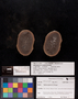 PP 27291 A+B [HS, M] Plantae, Moscovian / Desmoinesian, Francis Creek Shale Member, United States of America, Illinois, Mazon Creek Region